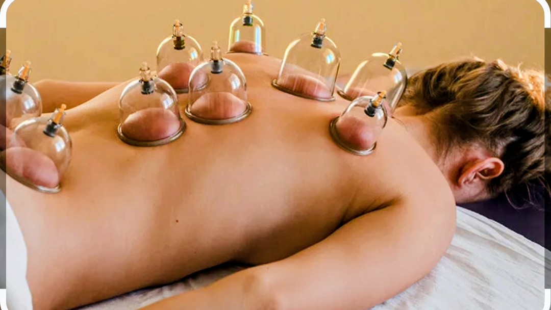 Cupping therapy on a client's back